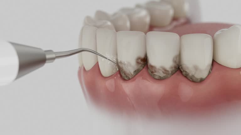 Reliable Dental contractor in Sioux Falls, SD by Smile Center Dentistry